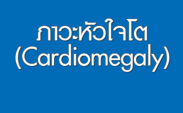 ภาวะหัวใจโต (Cardiomegaly)