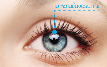 โรคเบาหวานขึ้นตา Diabetic Retinopathy