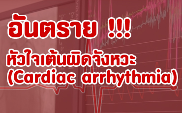 หัวใจเต้นผิดจังหวะ (Cardiac arrhythmia)