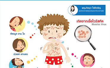 โรคหัด ( Measles )