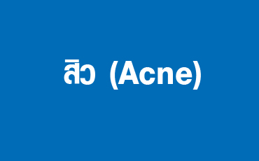 สิว (Acne)