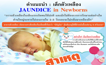 คำแนะนำ : เด็กตัวเหลือง Jaundice in Newborns