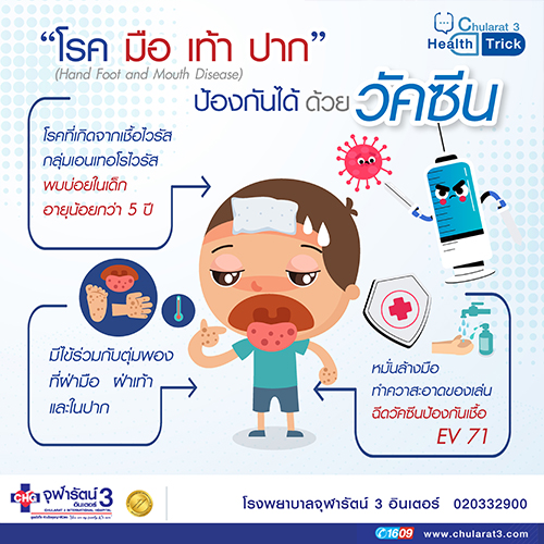 โรคมือ เท้า ปาก ป้องกันได้ ด้วยวัคซีน