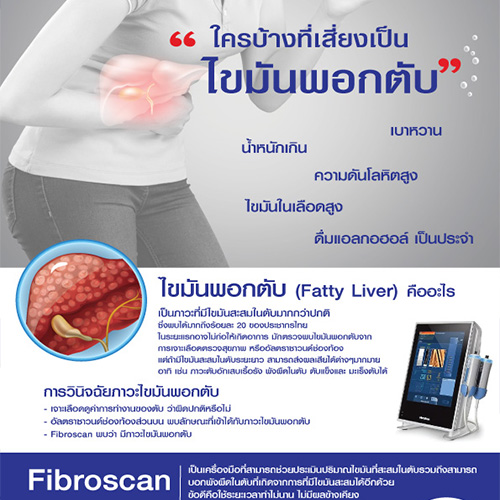 ภาวะไขมันพอกตับ(Fatty liver)