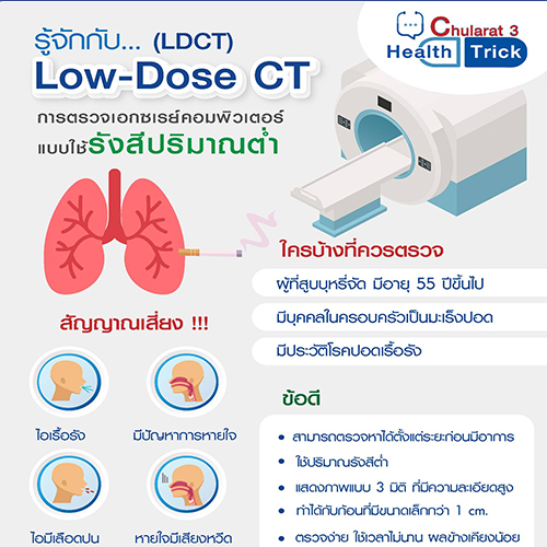 รู้จักกับ  Low-Dose CT (LDCT)