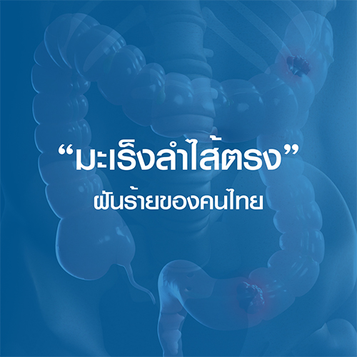 มะเร็งลำไส้ตรง...ฝันร้ายของคนไทย