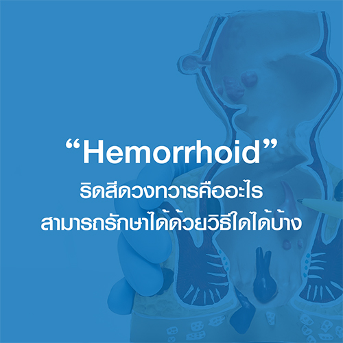 ริดสีดวงทวาร (Hemorrhoid) คืออะไร สามารถรักษาได้ด้วยวิธีใดบ้าง