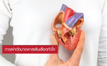 Cardiovascular Surgery : CABG Valvular Surgery - โรงพยาบาลจุฬารัตน์ 3 อินเตอร์