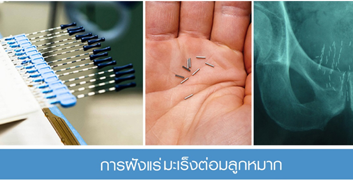 โรคระบบทางเดินปัสสาวะ